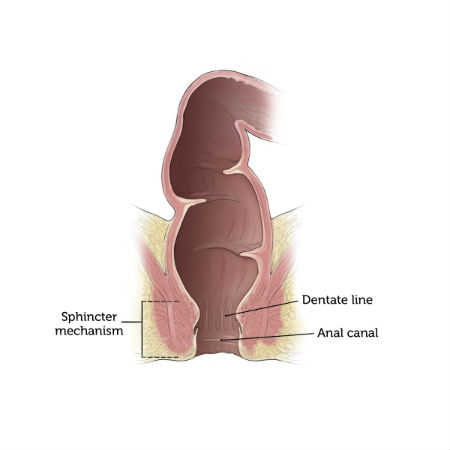 A look at an unblocked bowel after it was repaired with the pull-through procedure.
